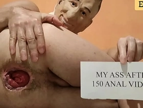 my ass after 150 extreme anal videos