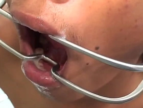 Asia twink fingered and breeded by medic for cum in mouth